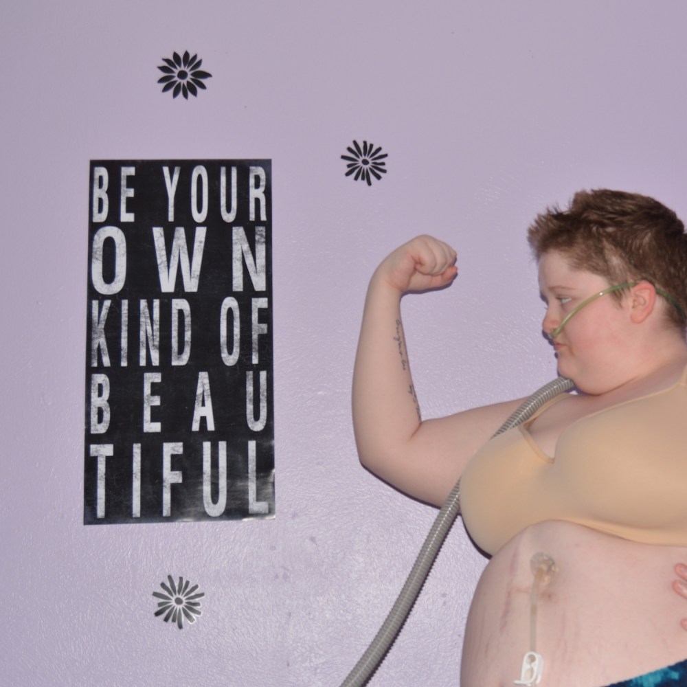 Madison stands facing right with her right arm raised in a fist. She has a breathing tube in, and is wearing a beige bra. She stands next to a black and white poster which reads: "Be Your Own Kind of Beautiful."