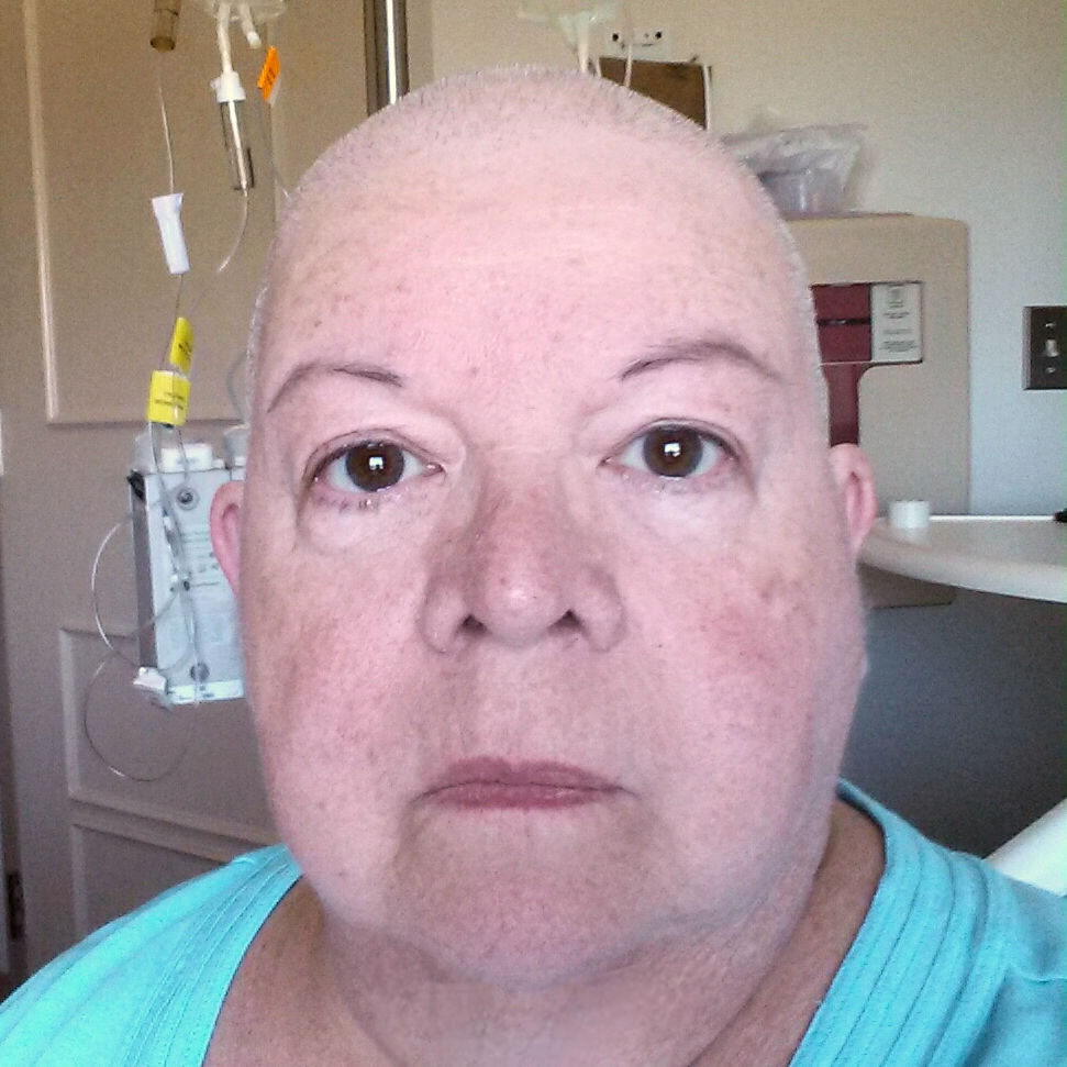 suzi-duke-post-transplant